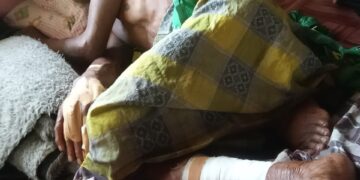 Anmat Komang terbaring lemah usai digigit buaya muara Tanjung Saleh, Rabu, 10 April 2024.