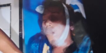 Korban Fitri Amalia tewas dibunuh oleh mantan suaminya. Hingga kini belum diketahui apa motif yang melatarbelakangi pelaku nekad menghabisi mantan istrinya.